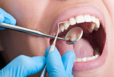 parodontologia (1)